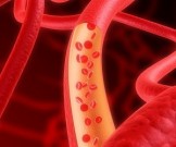 Витамины и микроэлементы для укрепления сосудов Витамины и микроэлементы для укрепления сосудов