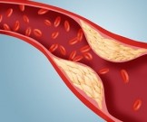 Как снизить уровень холестерина: 8 доступных способов