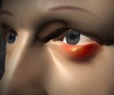 Быстрое избавление от ячменя: 10 действенных рецептов Быстрое избавление от ячменя: 10 действенных рецептов