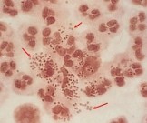 Внешняя среда и гонококковый фарингит Внешняя среда и гонококковый фарингит