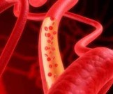 10 продуктов, которые прочистят артерии и защитят сердце 10 продуктов, которые прочистят артерии и защитят сердце