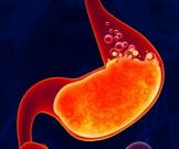 Недорогие средства для понижения кислотности и снятия воспаления: 4 рецепта