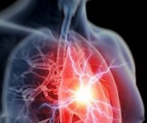 ТОП-10 необычных предвестников инфаркта ТОП-10 необычных предвестников инфаркта