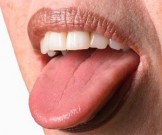 Белый налет на языке: 7 натуральных средств в помощь!