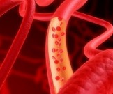 7 полезных коктейлей, которые очистят артерии 7 полезных коктейлей, которые очистят артерии