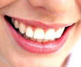 3 эффективных домашних средства против зубного камня 3 эффективных домашних средства против зубного камня