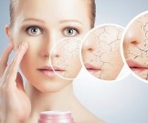 5 советов, как победить сухость кожи