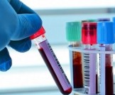 8 рекомендаций при сдаче крови на анализ 8 рекомендаций при сдаче крови на анализ