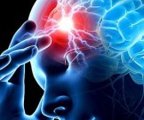 Как избежать внезапного инсульта