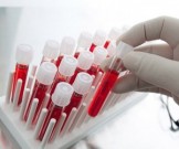 Пониженный гемоглобин: причины, симптомы и последствия Пониженный гемоглобин: причины, симптомы и последствия