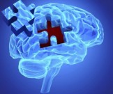 Апноэ и болезнь Альцгеймера могут быть взаимосвязаны Апноэ и болезнь Альцгеймера могут быть взаимосвязаны