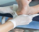Натуральные методы лечения диабетической стопы