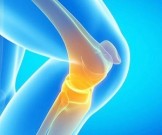 Универсальный рецепт для очищения суставов