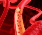 11 несложных способов для улучшения циркуляции крови 11 несложных способов для улучшения циркуляции крови