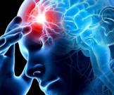 6 возможных причин инсульта, о которых многие не догадываются 6 возможных причин инсульта, о которых многие не догадываются