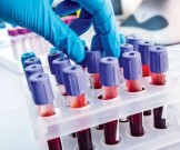 Анализ крови может использоваться для прогноза смерти Анализ крови может использоваться для прогноза смерти