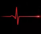 11 признаков того, что у вас может случиться остановка сердца