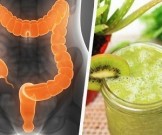 3 полезных напитка при синдроме раздраженного кишечника 3 полезных напитка при синдроме раздраженного кишечника