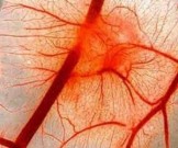 5 действенных рецептов для укрепления сосудов