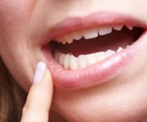 5 стоматологических проблем, которые указывают на серьезные заболевания