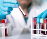 Анализ крови выявит рак легких за 5 лет до начала процесса Анализ крови выявит рак легких за 5 лет до начала процесса