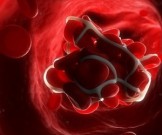 5 ранних признаков высокого уровня сахара в крови 5 ранних признаков высокого уровня сахара в крови