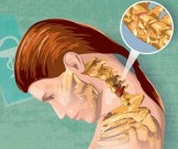 Как не просыпаться разбитым при шейном остеохондрозе Как не просыпаться разбитым при шейном остеохондрозе
