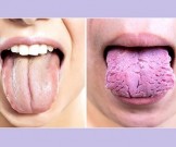3 вещи, которые ваш язык пытается рассказать о вашем здоровье 3 вещи, которые ваш язык пытается рассказать о вашем здоровье