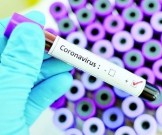 ВОЗ назвала наиболее уязвимую возрастную группу для коронавируса ВОЗ назвала наиболее уязвимую возрастную группу для коронавируса