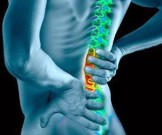 Как предотвратить радикулит: 8 поз для профилактики