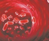 Чем опасны тромбы, и можно ли обезопасить себя Чем опасны тромбы, и можно ли обезопасить себя