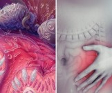 Оптимальный рацион для исцеления кишечника