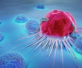 16&nbsp;молчаливых признаков лейкемии, которые очень легко не заметить