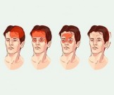Как остановить головные боли за 5 минут без лекарств Как остановить головные боли за 5 минут без лекарств