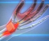 6 средств, которые помогут при боли в запястье 6 средств, которые помогут при боли в запястье