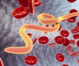 Доступный способ, который поможет быстро избавиться от паразитов Доступный способ, который поможет быстро избавиться от паразитов
