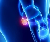 7 рецептов для улучшения состояния при аденоме простаты